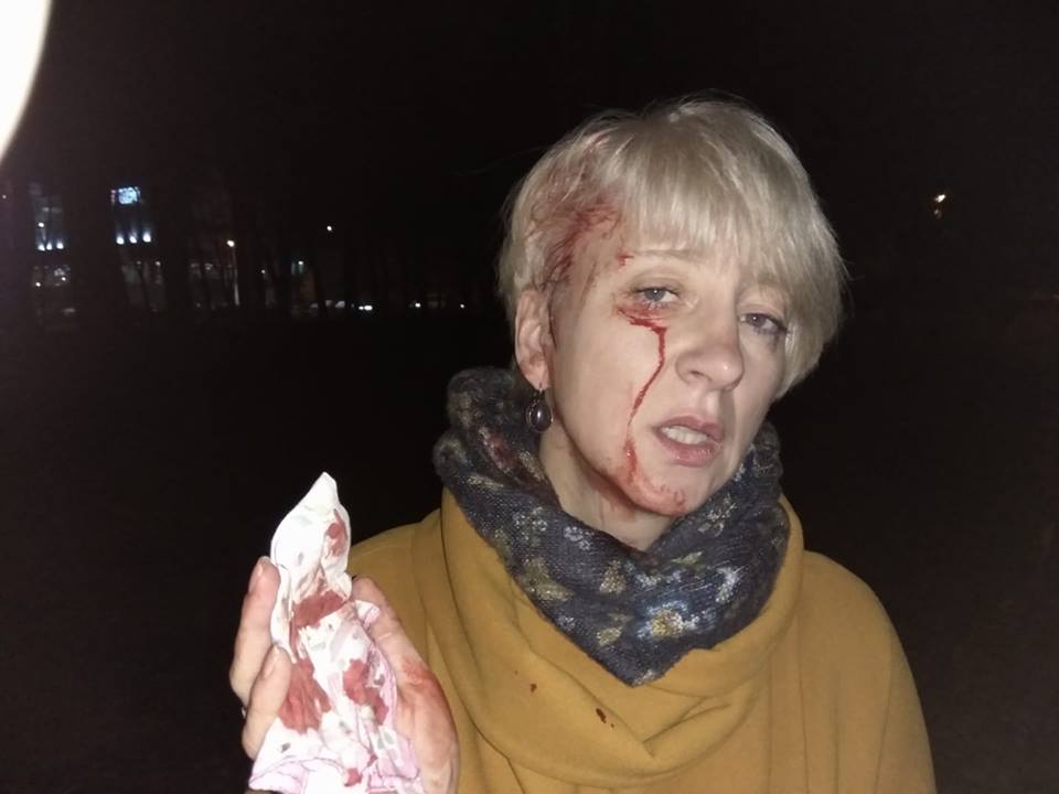 В Полтаве избили судью 1 23754820 311299139276895 577811680456075746 n